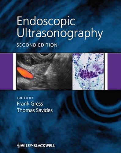 Stock image for Endoscopic Ultrasonography for sale by HPB-Red