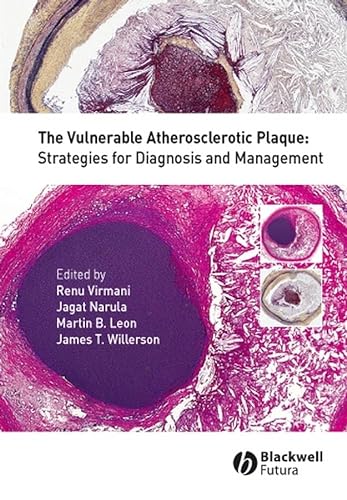 9781405158596: The Vulnerable Atherosclerotic Plaque: Strategies for Diagnosis and Management