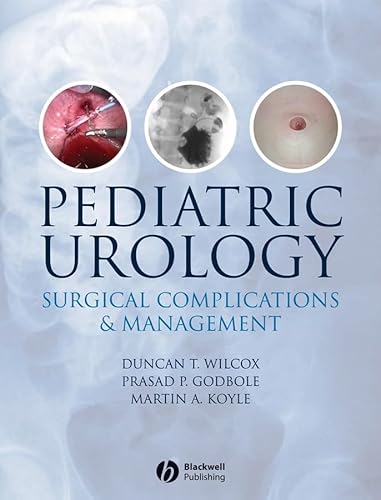Stock image for Pediatric Urology: Surgical Complications and Management for sale by bmyguest books