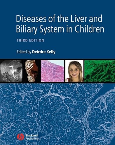 9781405163347: Diseases of the Liver and Biliary System in Children