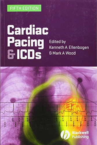 9781405163507: Cardiac Pacing and ICDs