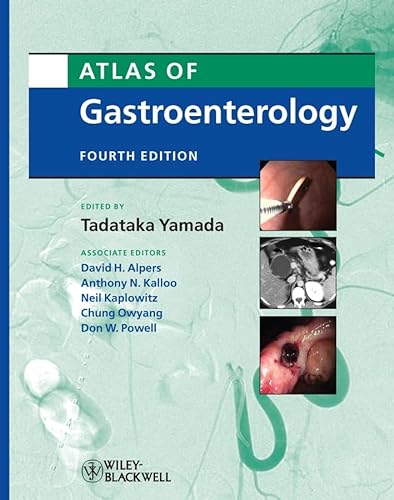 Stock image for Atlas of Gastroenterology for sale by Better World Books