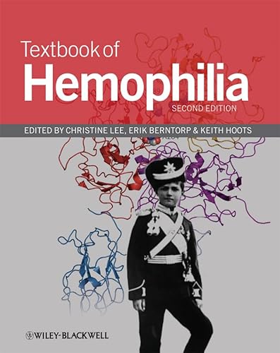 Imagen de archivo de Textbook of Hemophilia a la venta por BookHolders