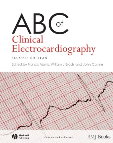 Beispielbild fr ABC of Clinical Electrocardiography zum Verkauf von Anybook.com