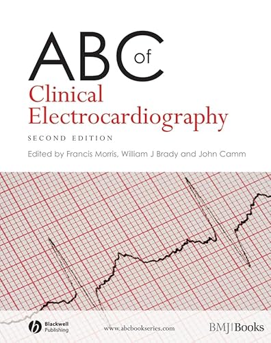 Imagen de archivo de ABC of Clinical Electrocardiography a la venta por Anybook.com