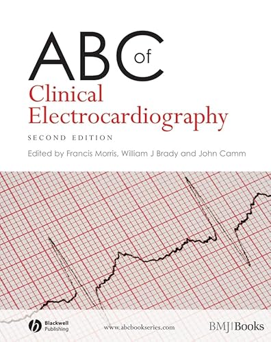 Stock image for ABC of Clinical Electrocardiography for sale by Anybook.com