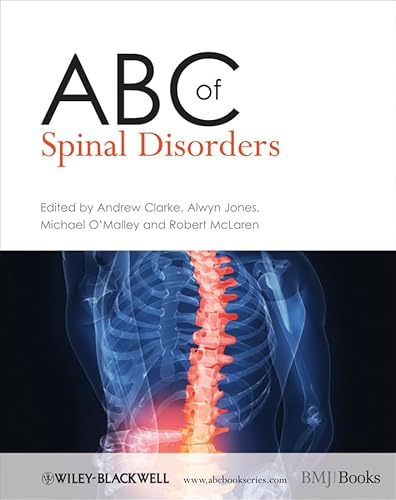 Stock image for ABC of Spinal Disorders (ABC Series) for sale by WorldofBooks