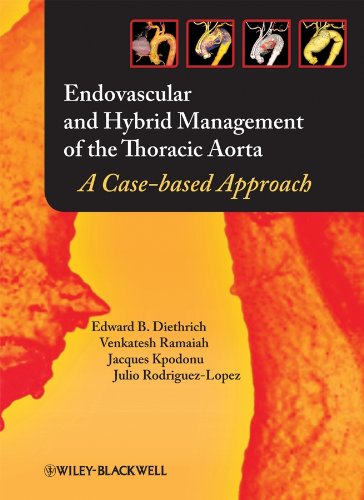 9781405175357: Endovascular and Hybrid Management of the Thoracic Aorta: A Case-based Approach