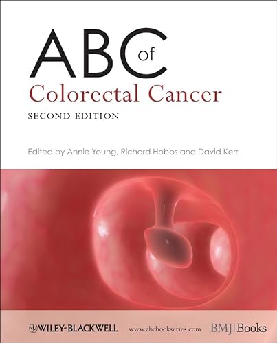 Stock image for ABC of Colorectal Cancer for sale by ThriftBooks-Dallas