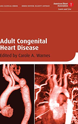 Adult Congenital Heart Disease (American Heart Association Clinical Series)