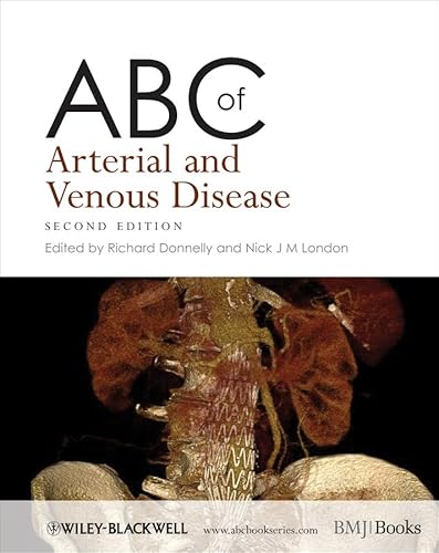 Beispielbild fr Arterial and Venous Disease zum Verkauf von Better World Books Ltd