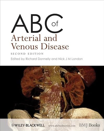 9781405178891: ABC of Arterial and Venous Disease
