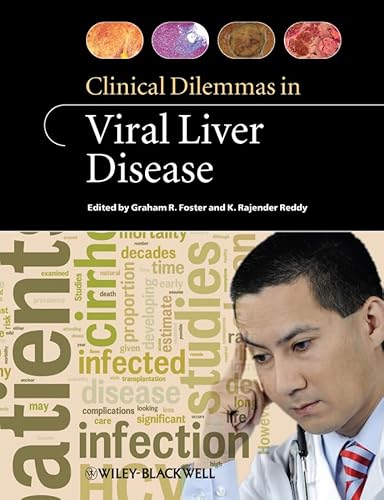 9781405179058: Clinical Dilemmas in Viral Liver Disease