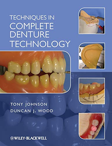 Beispielbild fr Techniques in Complete Denture Technology zum Verkauf von Blackwell's