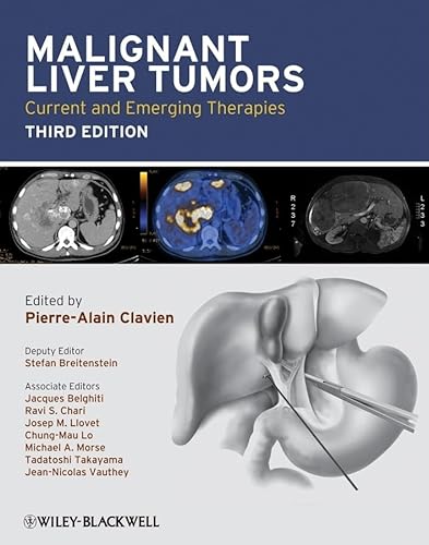 9781405179768: Malignant Liver Tumors: Current and Emerging Therapies