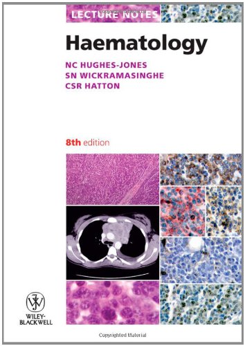 9781405180504: Lecture Notes: Haematology