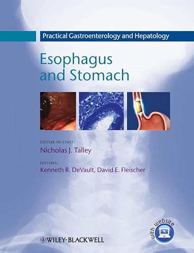 Beispielbild fr Practical Gastroenterology and Hepatology : Esophagus and Stomach zum Verkauf von Better World Books