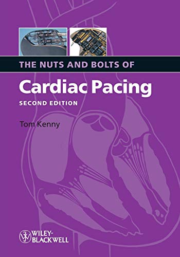 Beispielbild fr The Nuts and Bolts of Cardiac Pacing 2nd Edition by Kenny, Tom (2008) Paperback zum Verkauf von BooksRun