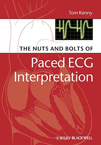 Beispielbild fr The Nuts and Bolts of Paced ECG Interpreting zum Verkauf von Blackwell's