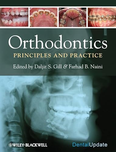 Stock image for Orthodontics: Principles and Practice for sale by Chiron Media