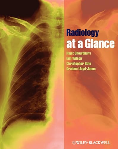 Beispielbild fr Radiology at a Glance zum Verkauf von WorldofBooks