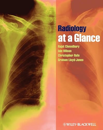 9781405192200: Radiology at a Glance
