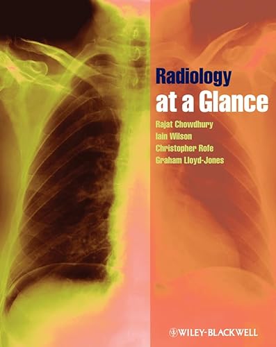 Imagen de archivo de Radiology at a Glance a la venta por Better World Books