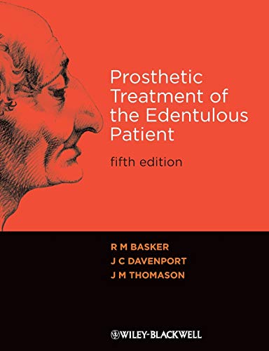 Stock image for Prosthetic Treatment of the Edentulous Patient for sale by Better World Books