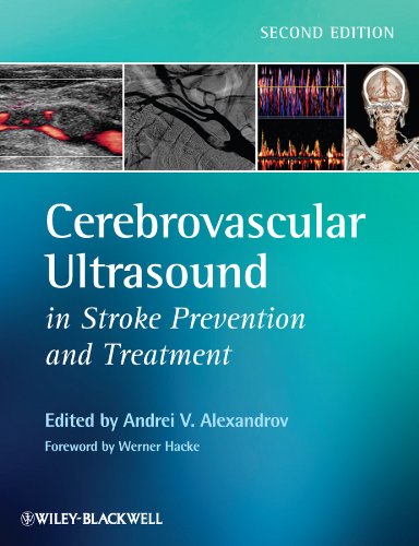 Beispielbild fr Cerebrovascular Ultrasound in Stroke Prevention and Treatment zum Verkauf von HPB-Red