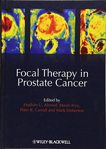 Imagen de archivo de Focal Therapy in Prostate Cancer a la venta por Chiron Media