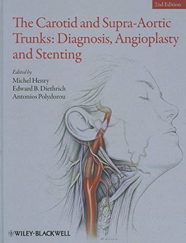 9781405198547: The Carotid and Supra-Aortic Trunks: Diagnosis, Angioplasty and Stenting