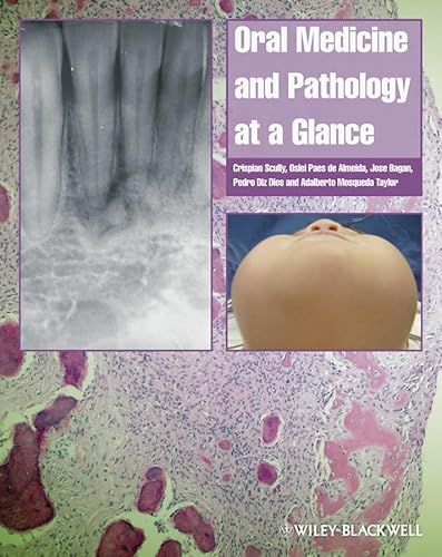Oral Medicine and Pathology at a Glance (9781405199858) by Scully, Crispian; Paes De Almeida, Oslei; Bagan, Jose; Diz Dios, Pedro; Mosqueda Taylor, Adalberto
