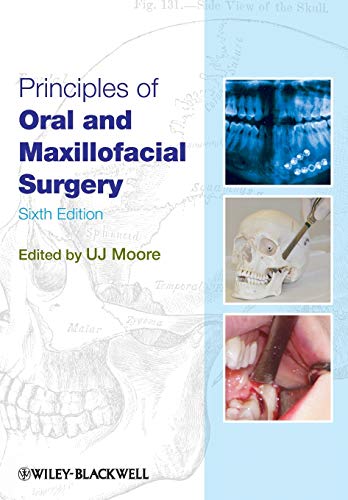 9781405199988: Principles of Oral and Maxillofacial Surgery