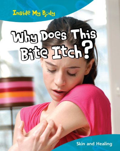 Why Does This Bite Itch? (Inside My Body) (9781406221077) by Parker, Steve