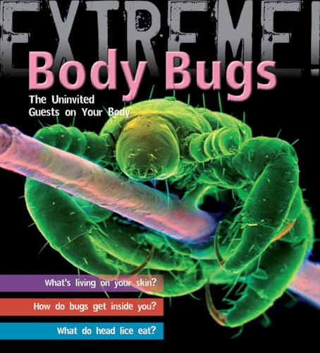 9781408100936: Extreme Science: Body Bugs!: The Uninvited Guests on Your Body