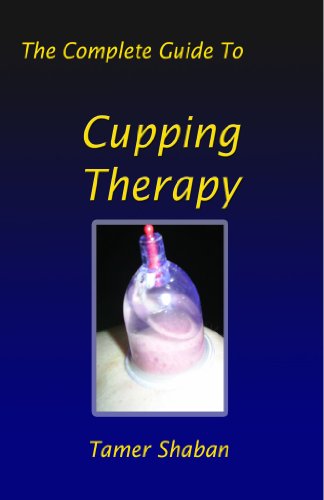 9781409219392: The Complete Guide To Cupping Therapy