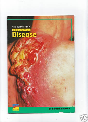Beispielbild fr The Human Body Discover Disease zum Verkauf von HPB-Red