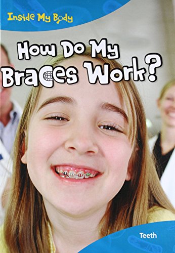 How Do My Braces Work?: Teeth (Inside My Body) (9781410940193) by Parker, Steve