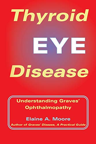 Beispielbild fr Thyroid Eye Disease: Understanding Graves' Ophthalmopathy zum Verkauf von KuleliBooks