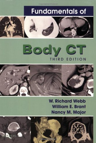 Imagen de archivo de Fundamentals of Body Ct (3rd Edition) a la venta por Once Upon A Time Books