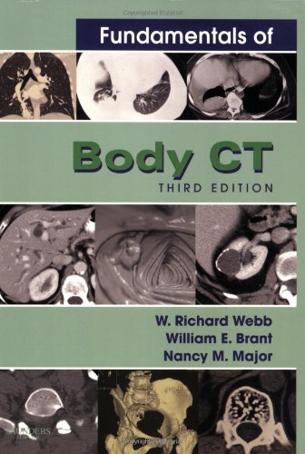 9781416000303: Fundamentals of Body CT, 3e (Fundamentals of Radiology)