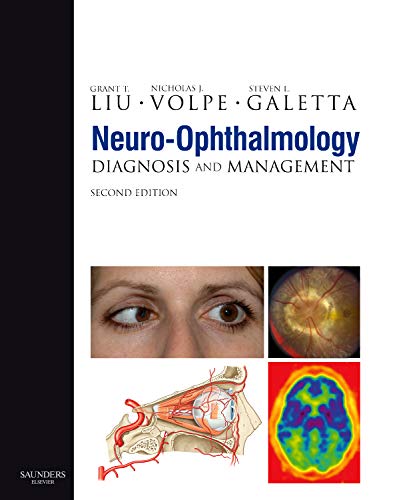 Neuro-Ophthalmology: Diagnosis and Management, Book with DVD-ROM - Liu MD, Grant T.; Volpe MD, Nicholas J.; Galetta MD, Steven L.