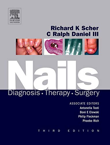 Nails: Diagnosis, Therapy, Surgery - Scher MD, Richard K.; Daniel MD, C. Ralph