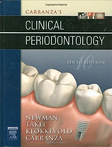 Carranza's Clinical Periodontology (9781416024002) by Michael G. Newman; Henry Takei; Fermin A. Carranza; Perry R. Klokkevold