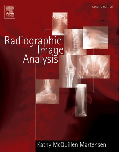 Beispielbild fr Radiographic Image Analysis zum Verkauf von Better World Books