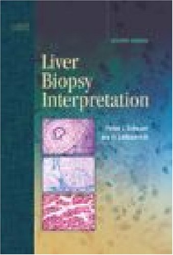 Imagen de archivo de Liver Biopsy Interpretation a la venta por More Than Words