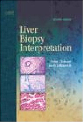 Stock image for Liver Biopsy Interpretation for sale by More Than Words