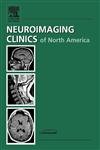 Stock image for Ophthalmologic Neuroimaging (Neuroimaging Clinics of North America: Volume 15, Number 1, February 2005) (Volume 15-1) for sale by Housing Works Online Bookstore