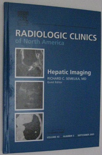 Stock image for Hepatic Imaging, An Issue of Radiologic Clinics (Volume 43-5) (The Clinics: Radiology, Volume 43-5) for sale by HPB-Red