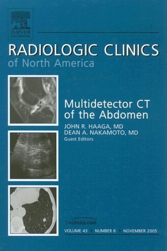 9781416027638: MDCT of the Abdomen, An Issue of Radiologic Clinics (Volume 43-6) (The Clinics: Radiology, Volume 43-6)